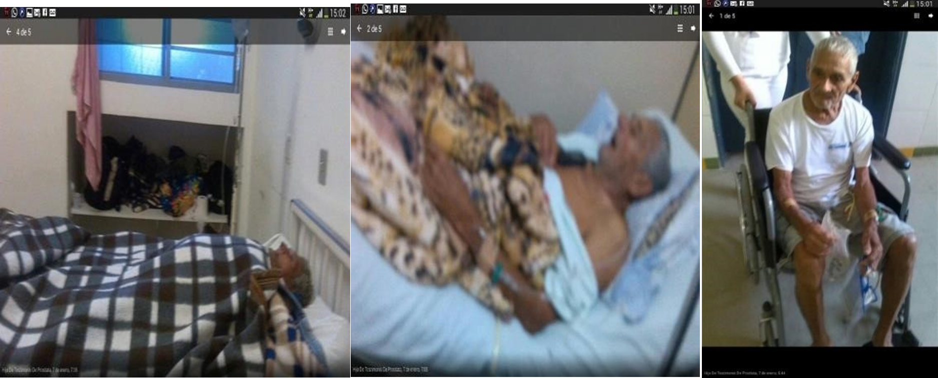 Before & After: Prostate Cancer